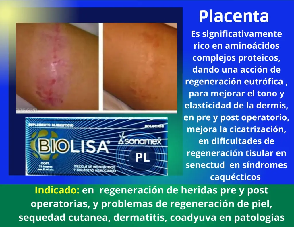 [PL] Placenta